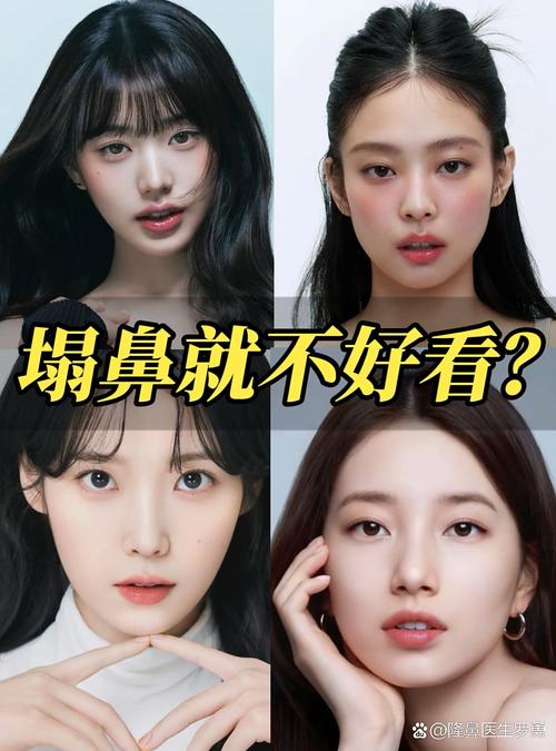 鼻根塌陷鼻头塌陷女人面相是什么？