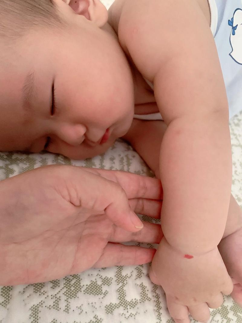胳膊或手腕上的胎记，是否暗示着前世的某种特殊缘分或命运？