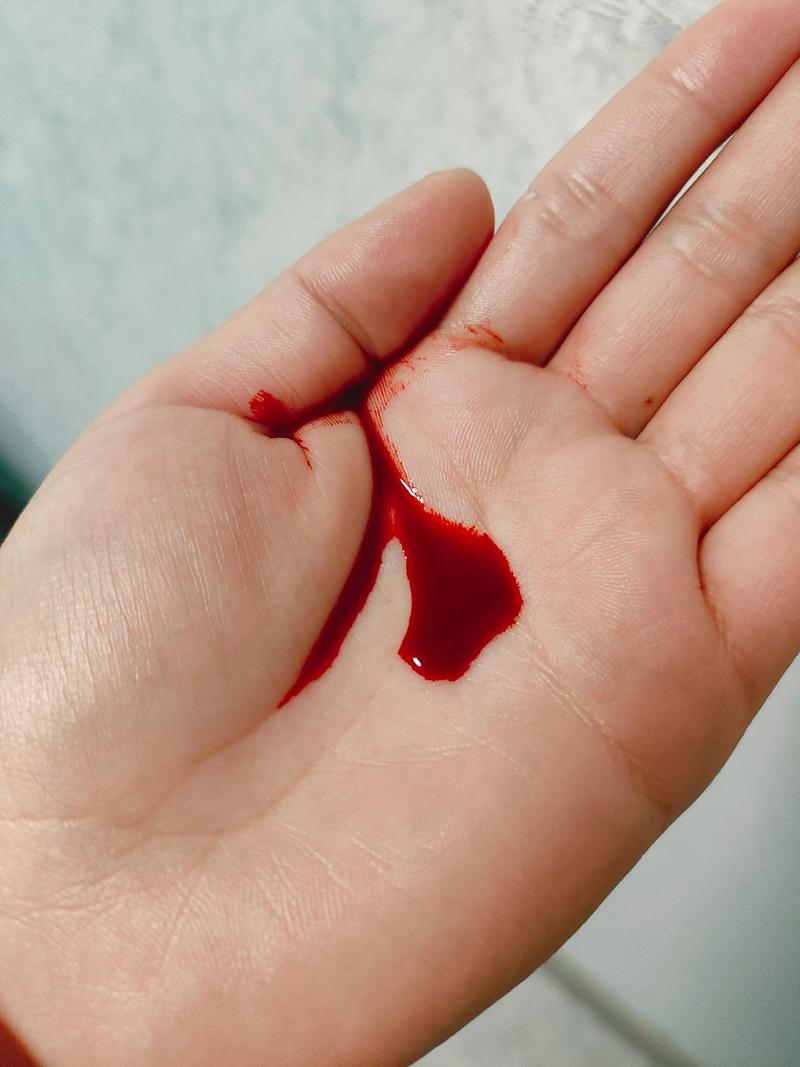 女人梦见手上沾满鲜血有什么兆头或预兆？