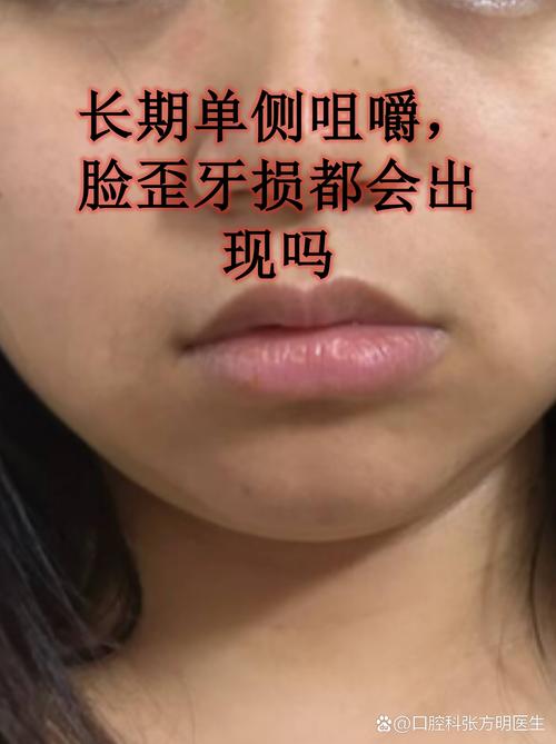 女人门牙歪面相预示着什么？牙齿在面相中代表什么含义？