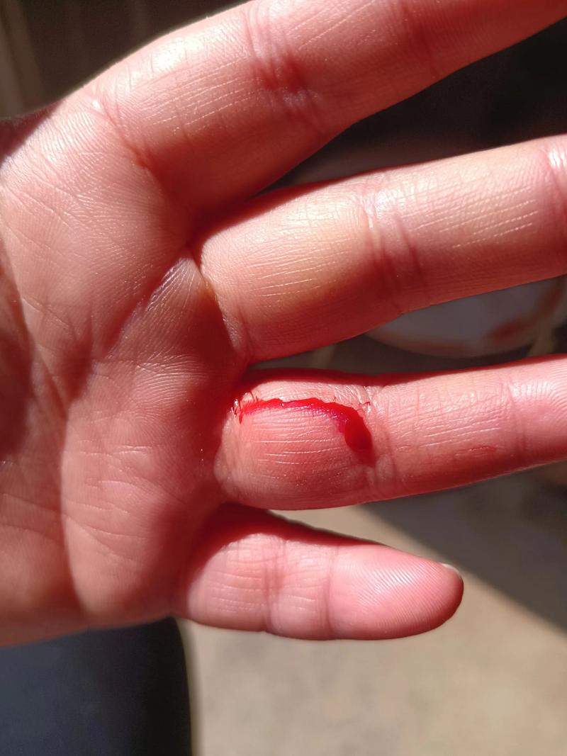 女人梦到手被划流血是什么征兆？预示着什么不好的事情即将发生？