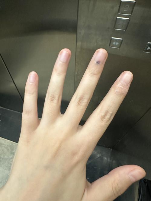 梦见手指被夹伤是什么预兆？