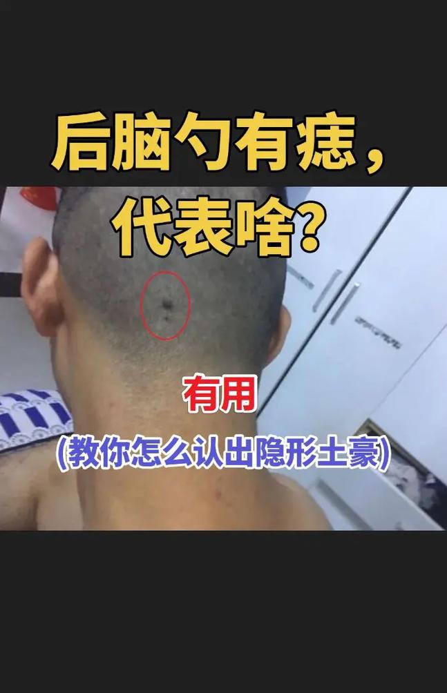 后脑勺有坑的面相有什么特别的运势优势？