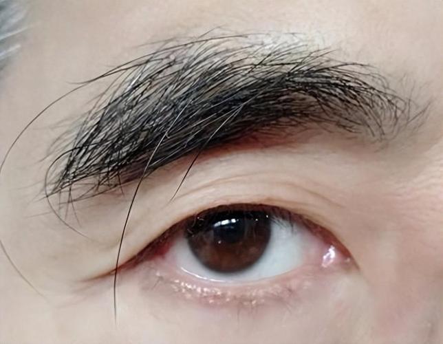 左右眉毛各有一根长的是否正常？
