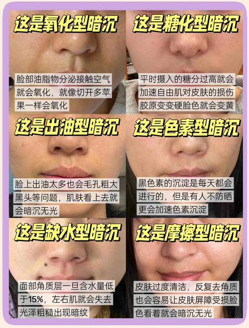 面相暗黄运势不好，脸色暗黄预示着什么运势不佳？