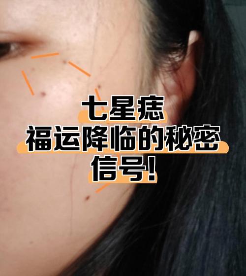 富贵七星痣长在哪些位置，会影响命运女人的脖子？