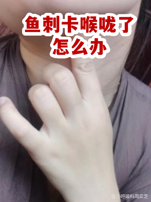 梦见嗓子卡鱼刺是什么预兆或象征？