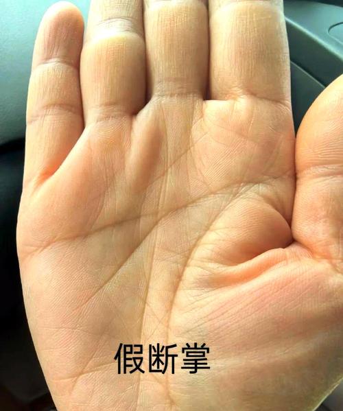 为什么假断掌在某种情况下被认为比真断掌更有优势？