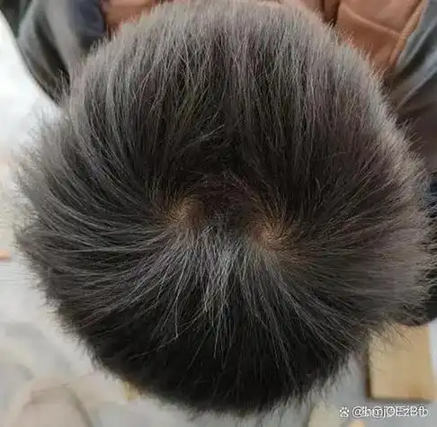 头顶双漩涡的人，他们的智慧是否超越了常人？