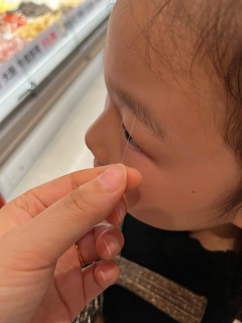 小孩眉毛长一根白眉毛，这是正常的吗？有什么影响？
