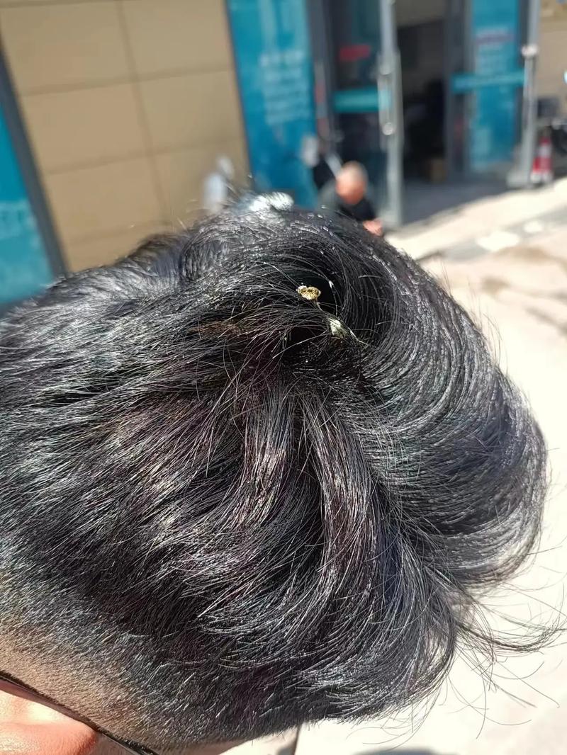 已婚女人梦见鸟屎掉头上，这预示着什么不幸的征兆？