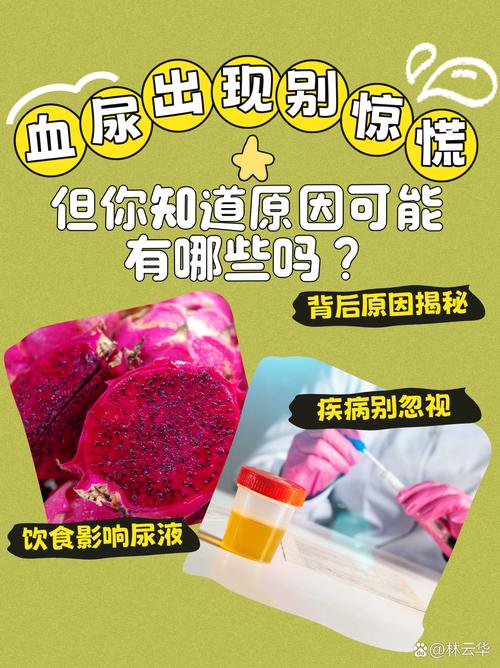 梦见小便是血是什么预兆或含义？