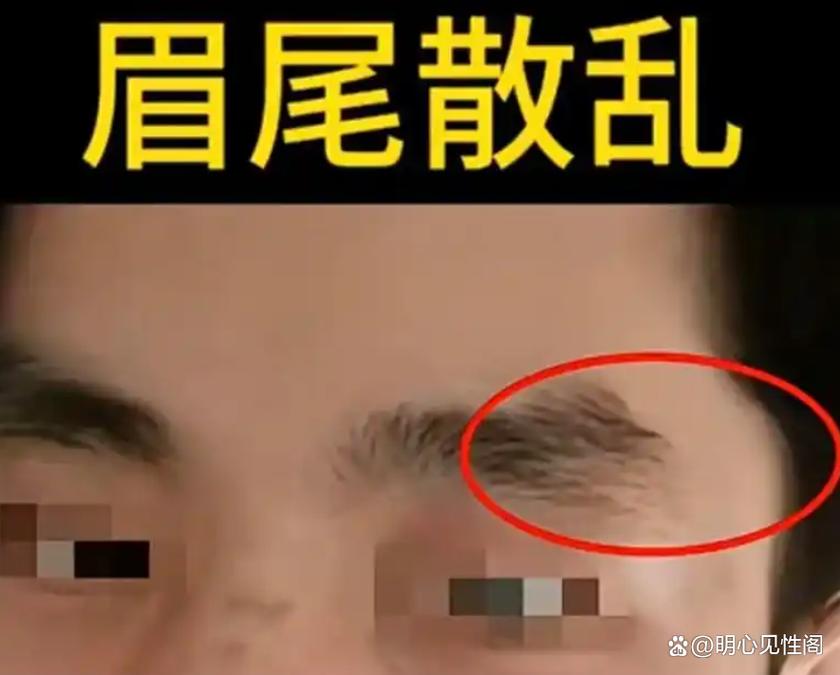 眉毛之间长旋是什么意思？有什么特殊含义吗？