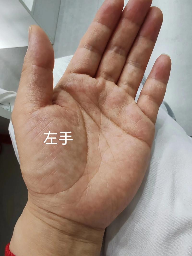 命运线究竟在手掌中如何体现？