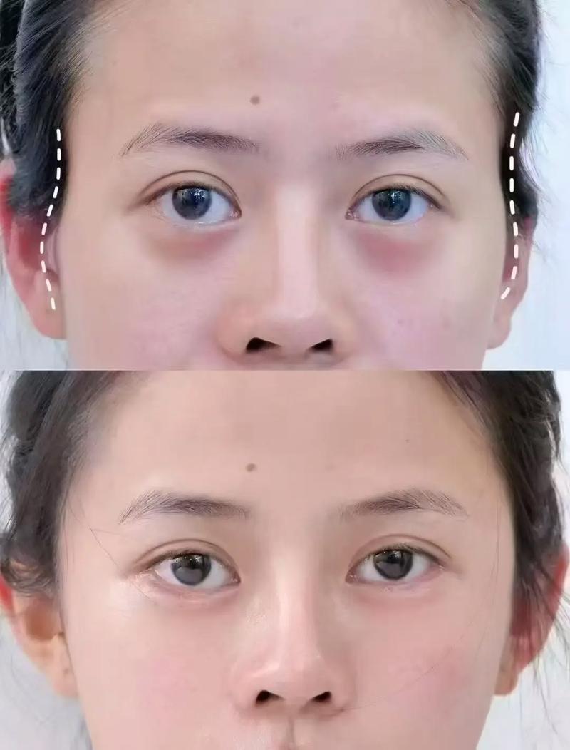 夫妻宫凹陷与饱满有何区别？哪种形态的夫妻宫更佳？