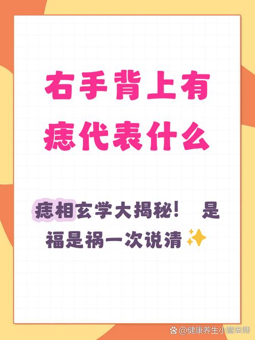 右手背长痣女人命运如何解析？这颗痣预示着什么？