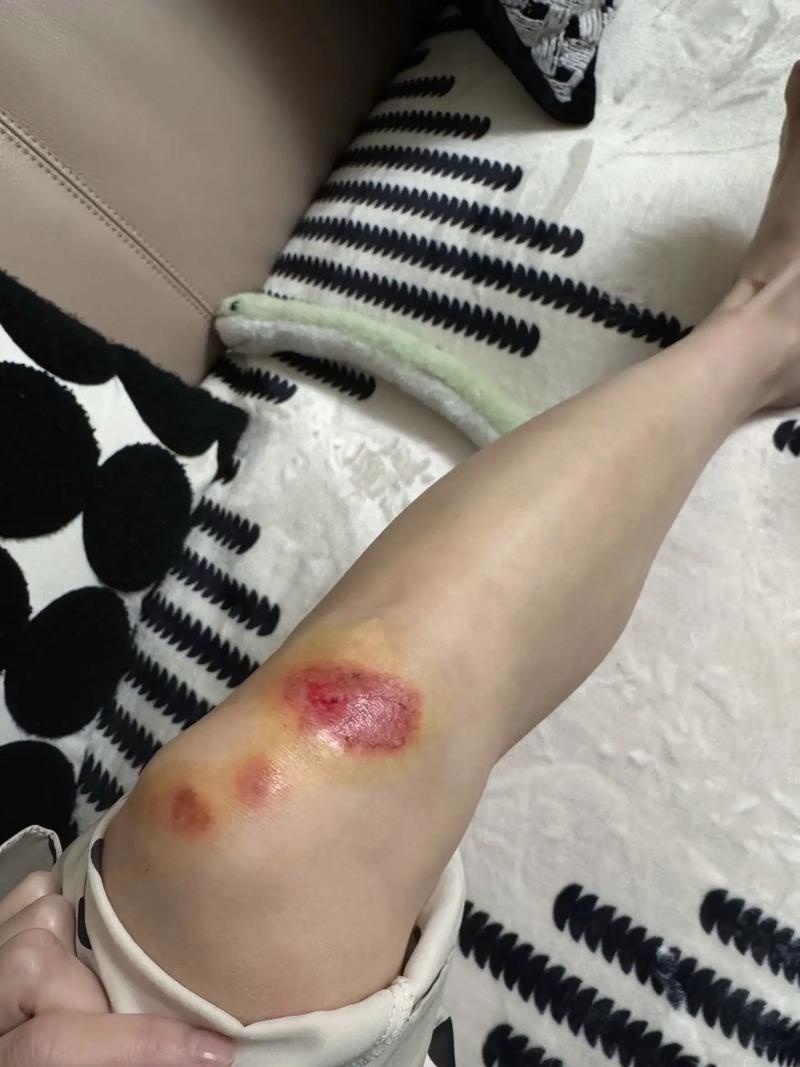 孕妇梦见骑车摔倒流血，三个月孕期这样的梦预示着什么？