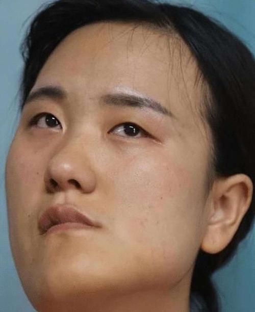 女子面相中，人中歪斜的特征有哪些？