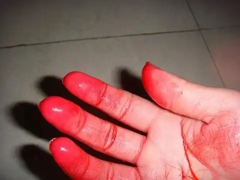 已婚女人梦见别人手指流血是什么不祥的预兆？