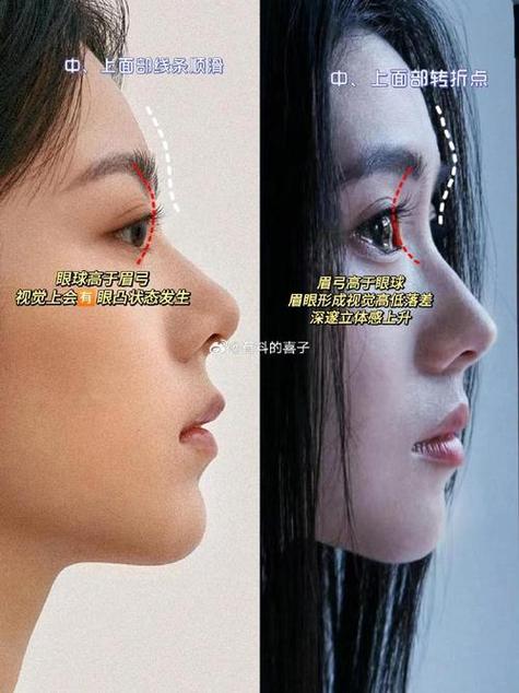 眉骨额头凸出是哪种面相的女孩特征？