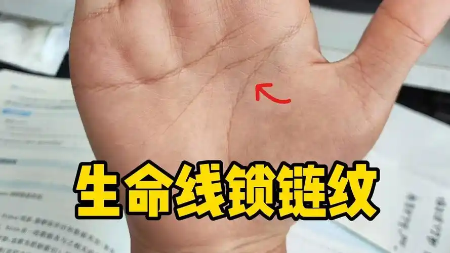 锁链纹手相是否意味着命运多舛，小孩手纹普遍是锁链吗？