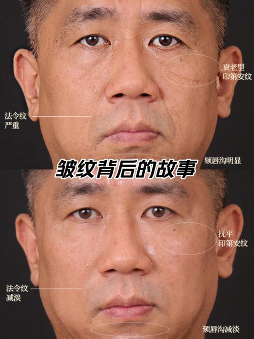什么样的男人面相有凤尾纹和罗网纹，算得上是凤尾纹面相男人？