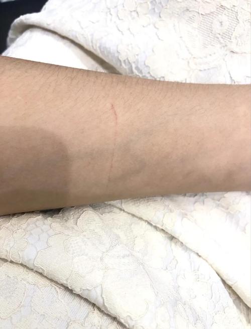 女人梦见被猫抓出血是什么不祥的预兆？