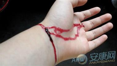 女人梦见手腕被割破流血，这预示着什么？