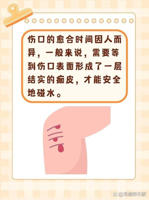 周公解梦：梦见自己腿摔伤是什么预兆或含义？