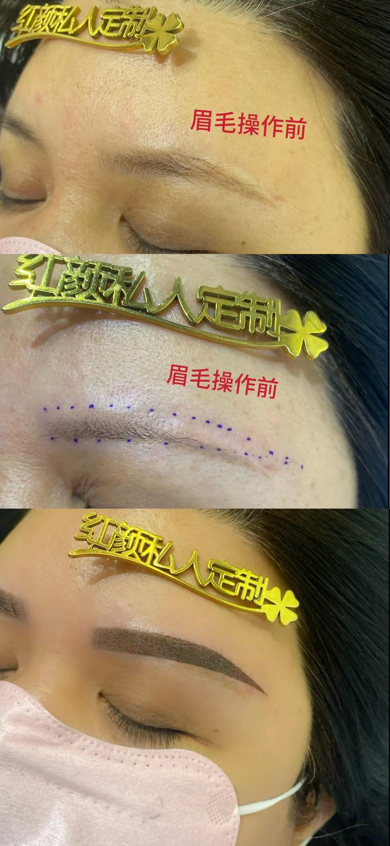 如何通过化妆技巧遮盖眉毛上的疤痕？