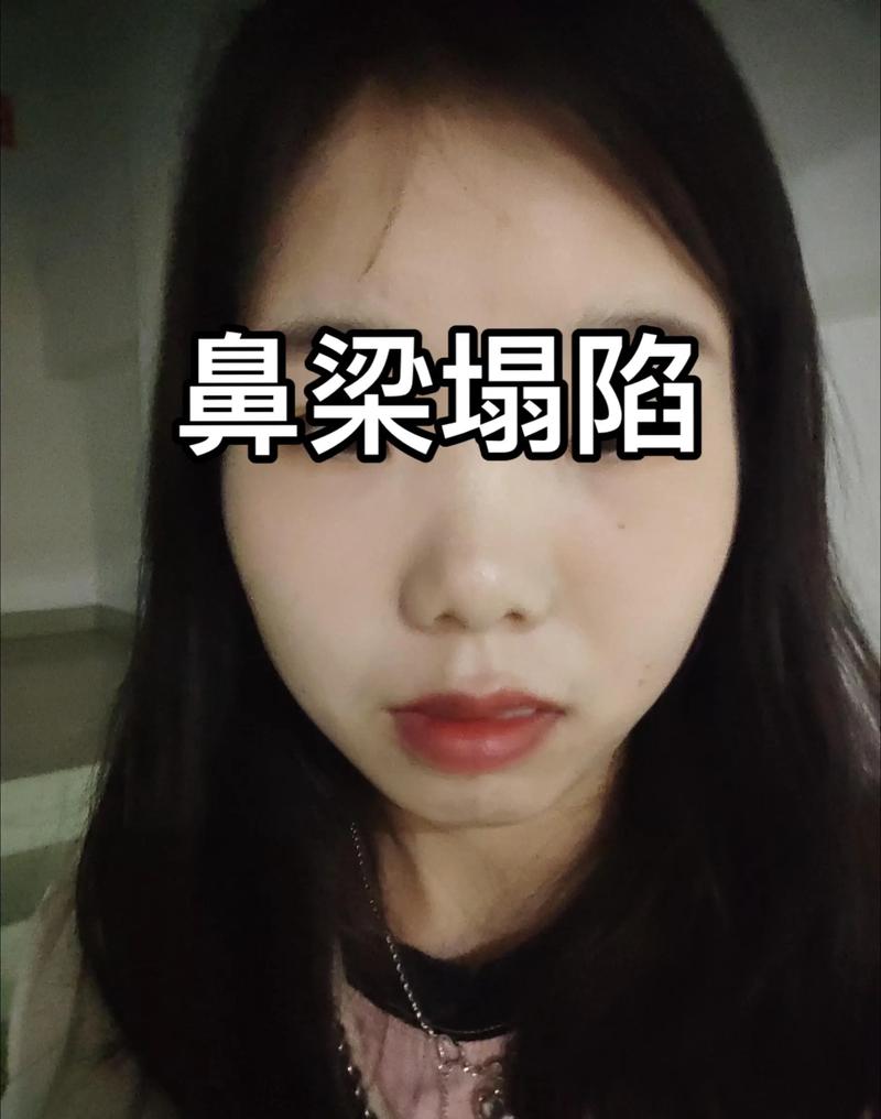 塌鼻梁女人财运如何，命运真的不好吗？