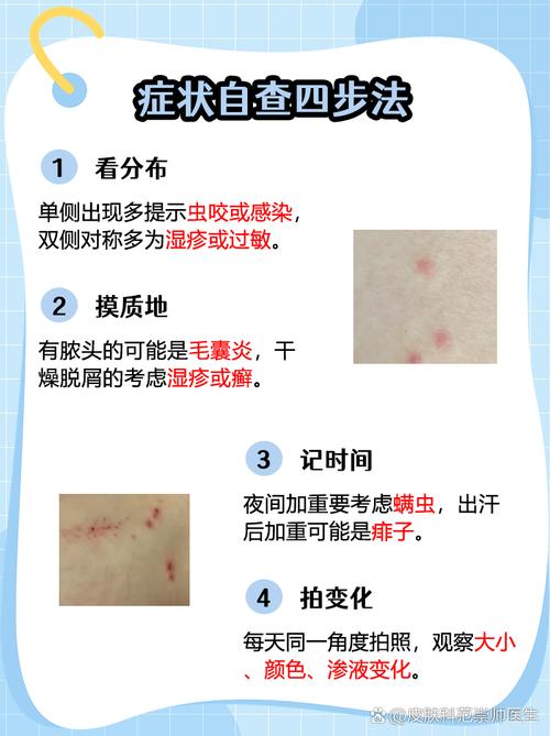 梦见自己腿上长了虫子，这究竟预示着什么不祥的征兆呢？