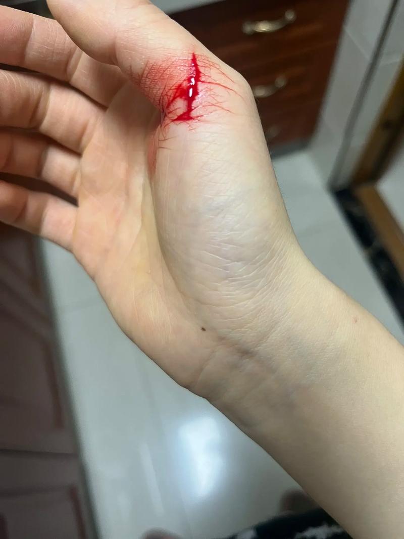 女人梦见手上沾满鲜血有什么兆头或预兆？
