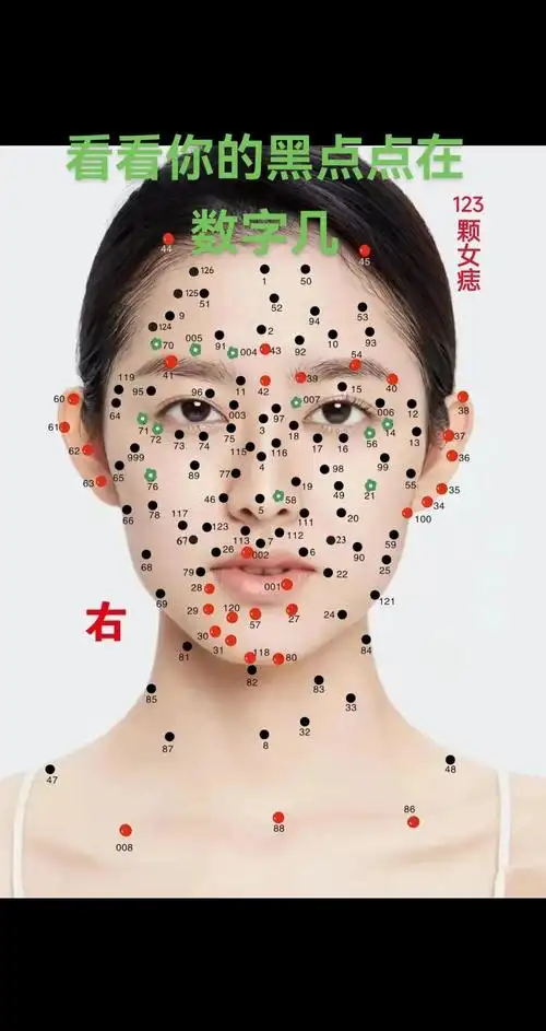 女人脸上哪些痣不宜触碰，会影响运势吗？