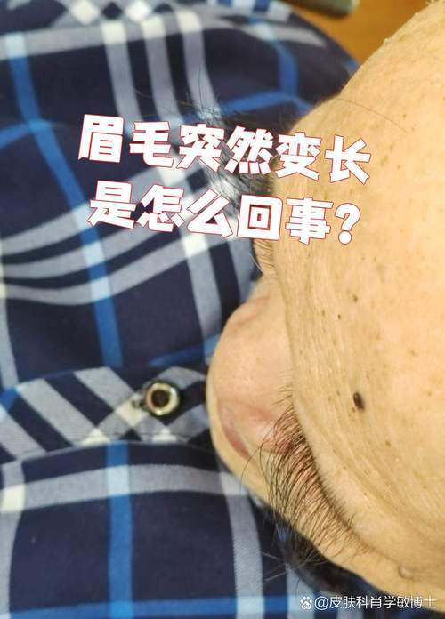 眉毛为什么会长得如此之长，是什么原因导致的呢？