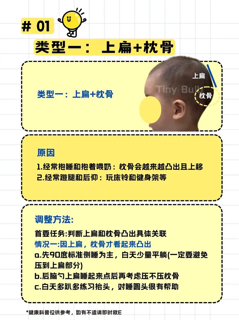 后脑勺扁平真的预示着富贵吗？老一辈为何偏爱平后脑勺？