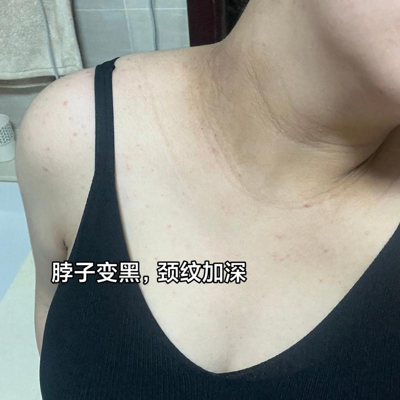 孕期梦见自己整容鼻子是什么预兆？