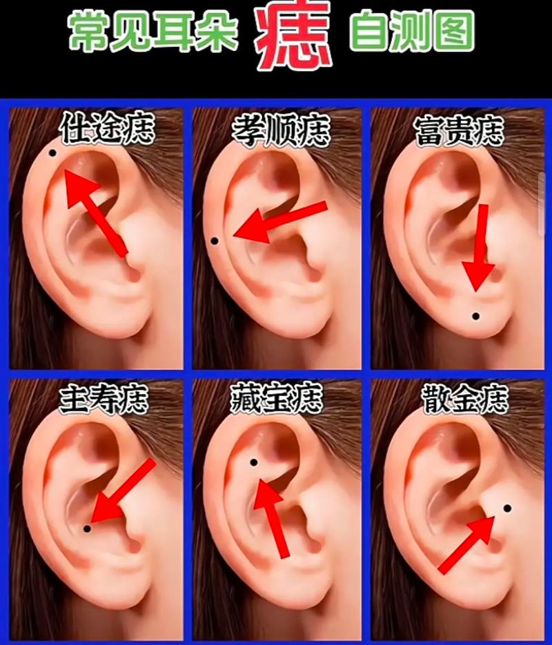 耳朵上长痣究竟预示着怎样的命运？