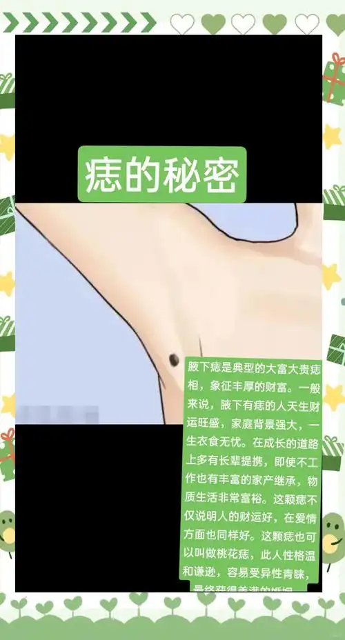 女人腋下有痣，是不是意味着旺夫旺子呢？