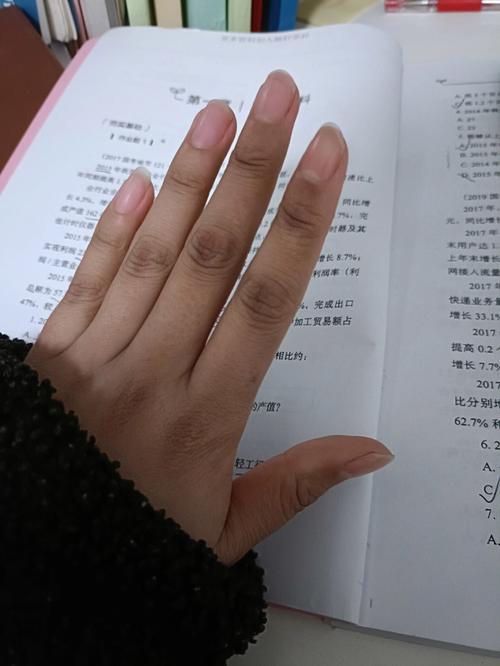 为什么同龄女孩中我的女儿手显得特别小？是正常现象还是需要关注？