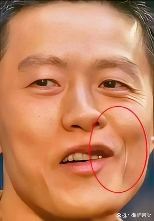 头歪嘴斜面相的人面相究竟意味着什么？