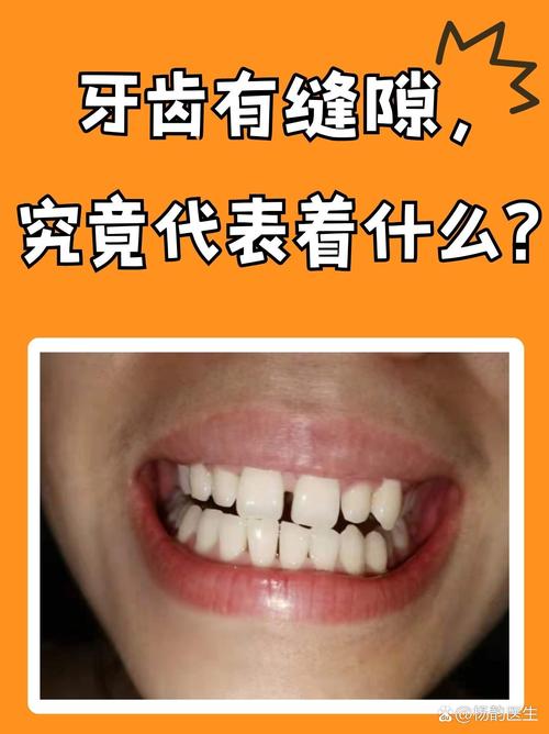 梦见牙齿之间有缝隙代表什么含义？预示着什么？