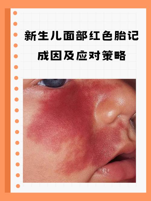 为什么有人两眉中间有红色胎记，面相风水有何说法？