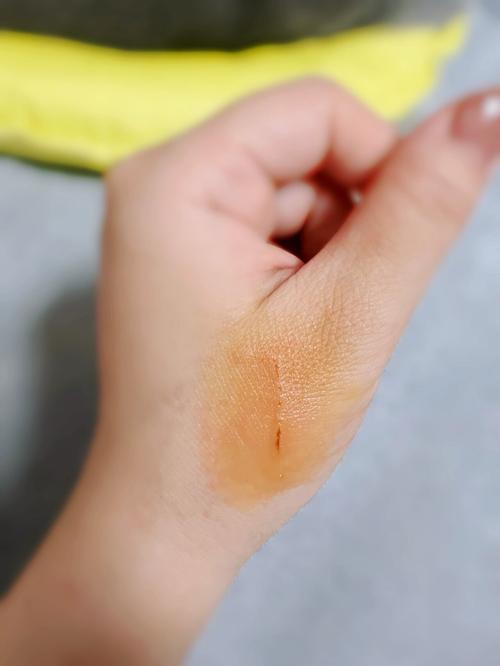 男人梦见被猫抓伤出血是什么不祥的预兆？