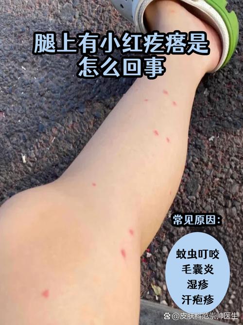 梦见自己腿上长了虫子，这究竟预示着什么不祥的征兆呢？