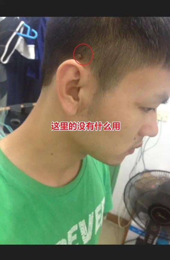 后脑勺有坑的面相有什么特别的运势优势？