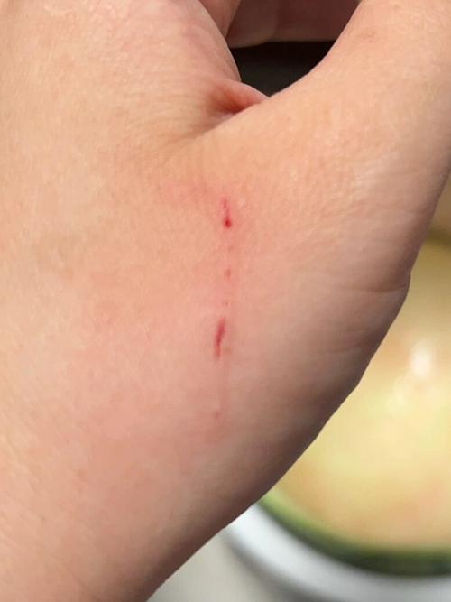 男人梦见被猫抓伤出血是什么不祥的预兆？