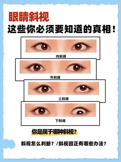 眼睛下方为何会出现两条类似八字形的斜线？