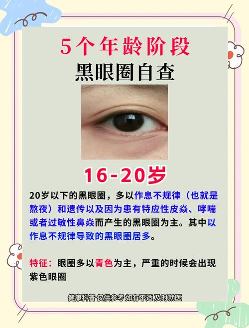 女性眼圈发黑重，面相暗示了什么健康或情绪问题？