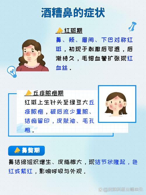 酒糟鼻面相预示命运如何？揭秘酒糟鼻面相好坏对人生的影响